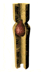 peristalsis